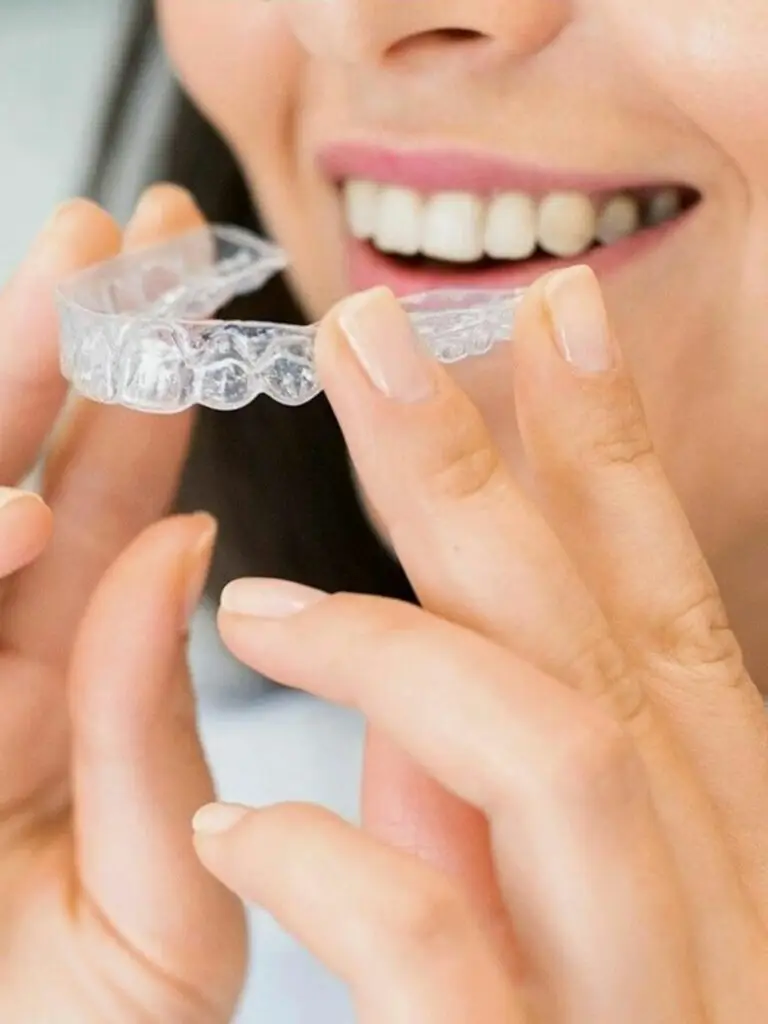 Invisalign, aligneurs dentaires transparents : Nos soins cabinet dentaire boujenah, paris 16